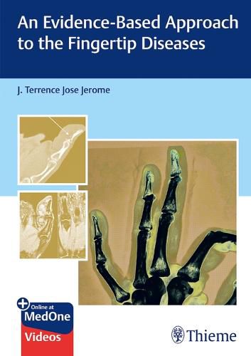 Cover image for An Evidence-Based Approach to the Fingertip Diseases