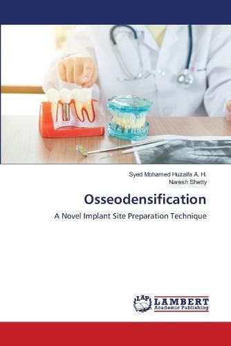 Cover image for Osseodensification