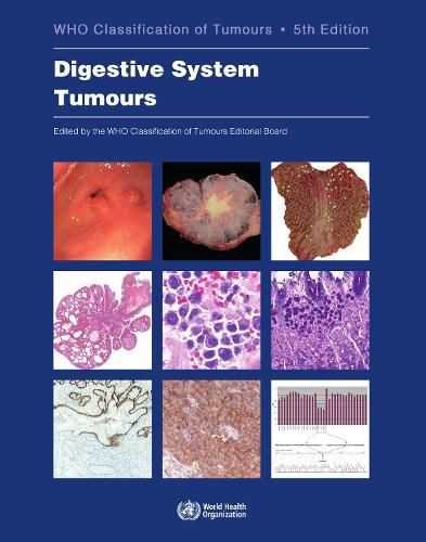 Cover image for WHO Classification of Tumours. Digestive System Tumours: WHO Classification of Tumours, Volume 1