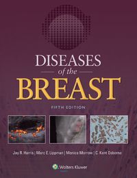 Cover image for Diseases of the Breast 5e