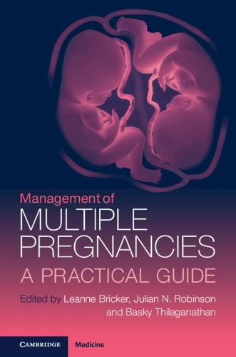 Management of Multiple Pregnancies: A Practical Guide