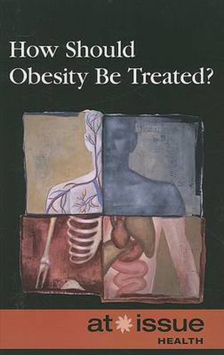 Cover image for How Should Obesity Be Treated?