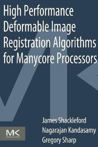 Cover image for High Performance Deformable Image Registration Algorithms for Manycore Processors