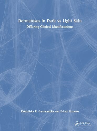 Cover image for Dermatoses in Dark Vs Light Skin