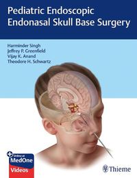 Cover image for Pediatric Endoscopic Endonasal Skull Base Surgery