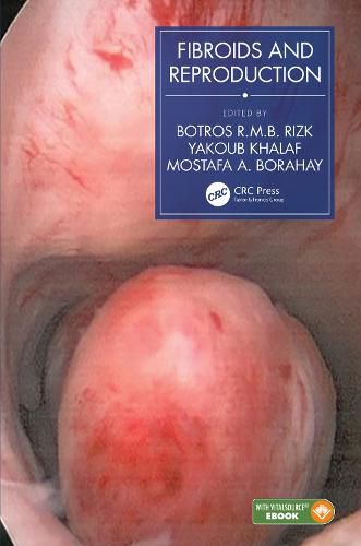 Cover image for Fibroids and Reproduction