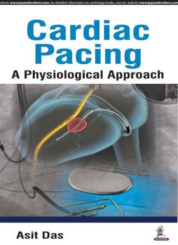 Cover image for Cardiac Pacing A Physiological Approach