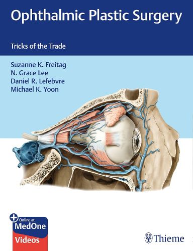 Cover image for Ophthalmic Plastic Surgery: Tricks of the Trade
