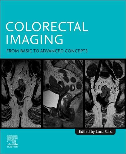 Colorectal Imaging