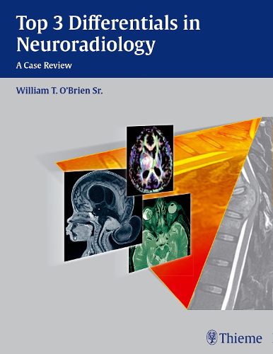 Cover image for Top 3 Differentials in Neuroradiology