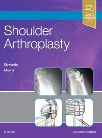 Cover image for Shoulder Arthroplasty