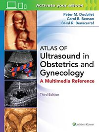 Cover image for Atlas of Ultrasound in Obstetrics and Gynecology