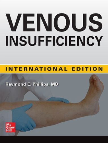 Cover image for Venous Insufficiency: Recognizing and Treating the Disease of Gravity