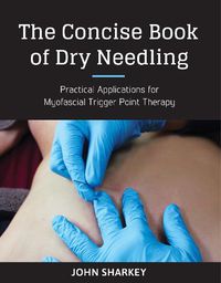 Cover image for The Concise Book of Dry Needling: A Practitioner's Guide to Myofascial Trigger Point Applications
