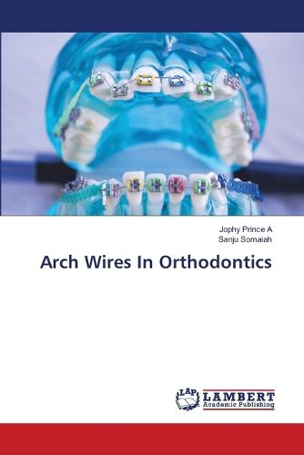 Cover image for Arch Wires In Orthodontics