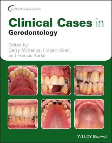 Cover image for Clinical Cases in Gerodontology