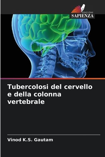 Cover image for Tubercolosi del cervello e della colonna vertebrale