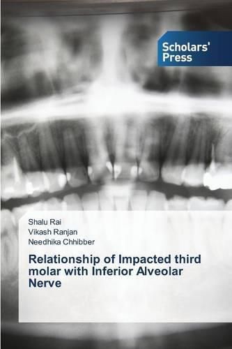 Cover image for Relationship of Impacted third molar with Inferior Alveolar Nerve