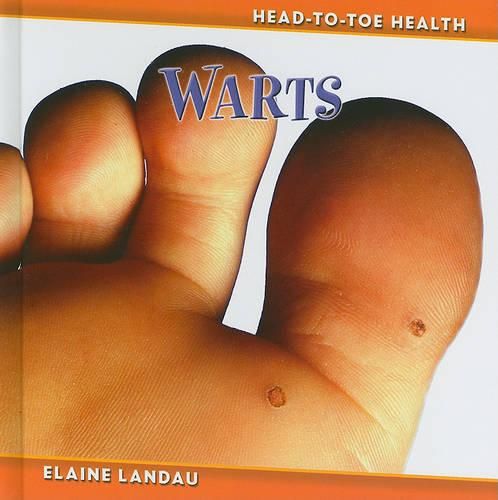 Cover image for Warts