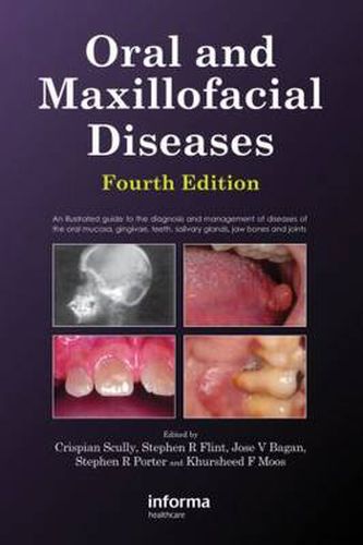 Cover image for Oral and Maxillofacial Diseases, Fourth Edition