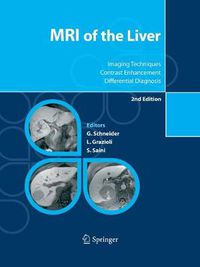 Cover image for MRI of the Liver: Imaging Techniques, Contrast Enhancement, Differential Diagnosis