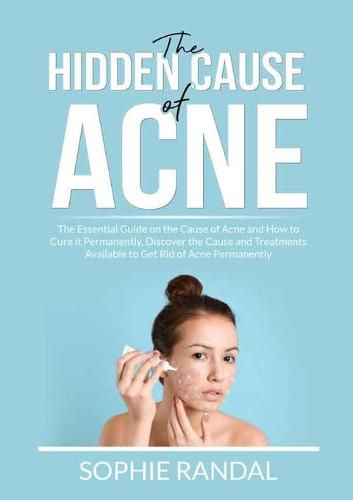 Cover image for The Hidden Cause of Acne: The Essential Guide on the Cause of Acne and How to Cure it Permanently, Discover the Cause and Treatments Available to Get Rid of Acne Permanently