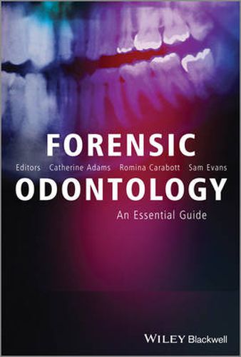 Cover image for Forensic Odontology: An Essential Guide