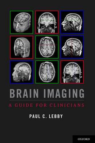 Cover image for Brain Imaging: A Guide for Clinicians