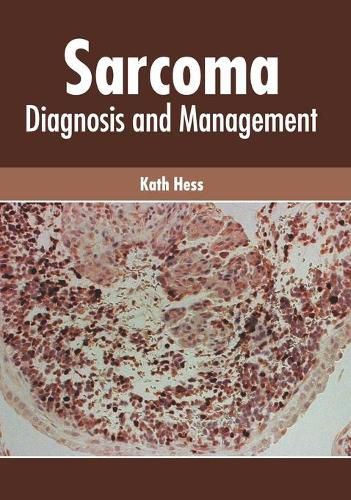 Cover image for Sarcoma: Diagnosis and Management