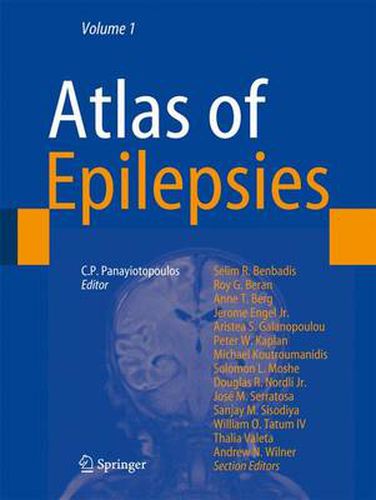 Cover image for Atlas of Epilepsies