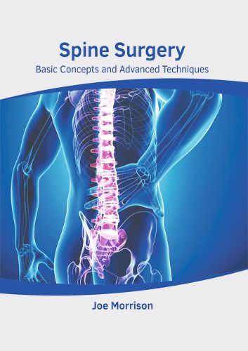 Cover image for Spine Surgery: Basic Concepts and Advanced Techniques