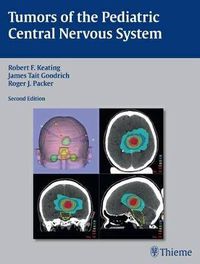 Cover image for Tumors of the Pediatric Central Nervous System