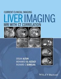 Cover image for Liver Imaging - MRI with CT Correlation