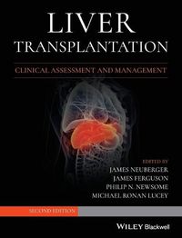 Cover image for Liver Transplantation: Clinical Assessment and Management