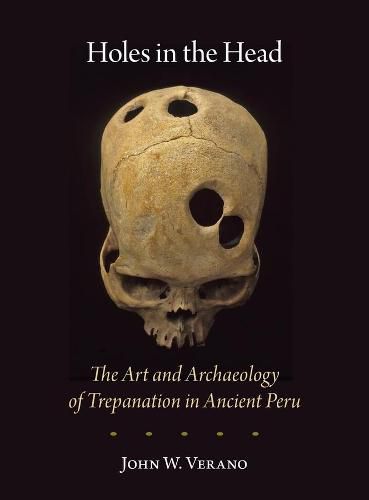 Cover image for Holes in the Head: The Art and Archaeology of Trepanation in Ancient Peru