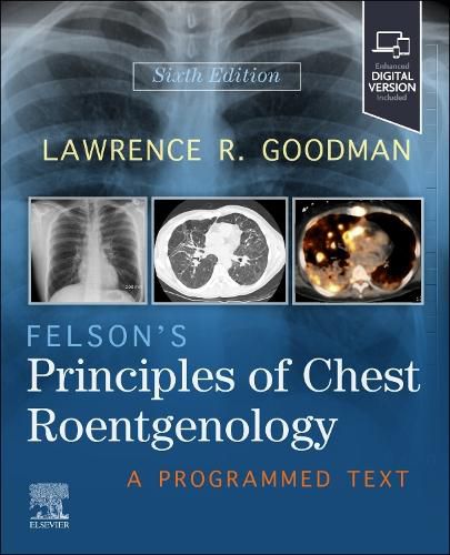 Cover image for Felson's Principles of Chest Roentgenology
