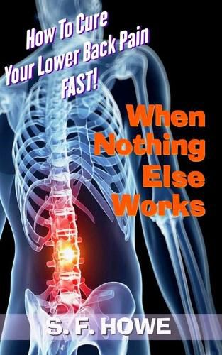 Cover image for When Nothing Else Works: How To Cure Your Lower Back Pain Fast!