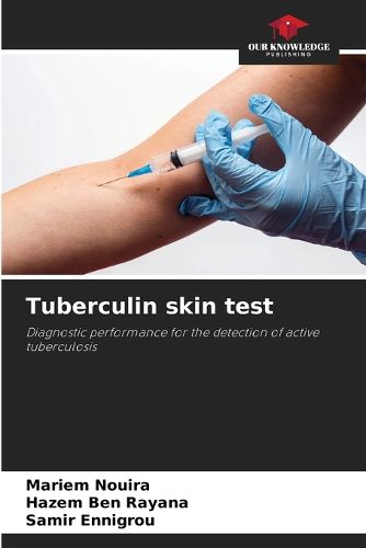 Cover image for Tuberculin skin test