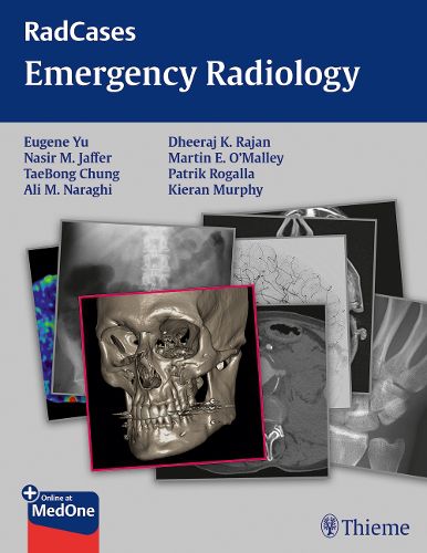 Radcases Emergency Radiology