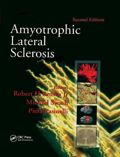 Cover image for Amyotrophic Lateral Sclerosis, Second Edition