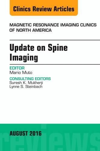 Cover image for Update on Spine Imaging, An Issue of Magnetic Resonance Imaging Clinics of North America