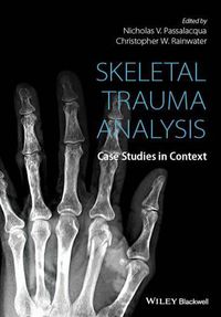 Cover image for Skeletal Trauma Analysis - Case Studies in Context