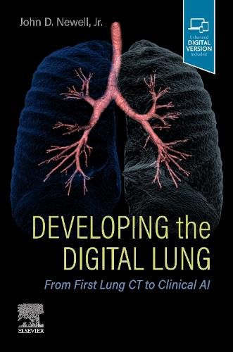 Cover image for Developing the Digital Lung: From First Lung CT to Clinical AI