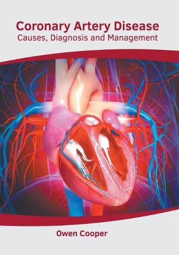 Cover image for Coronary Artery Disease: Causes, Diagnosis and Management