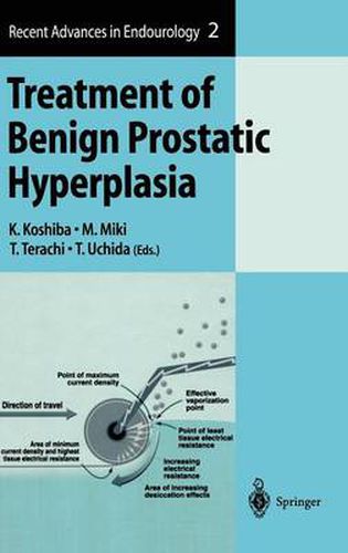 Cover image for Treatment of Benign Prostatic Hyperplasia