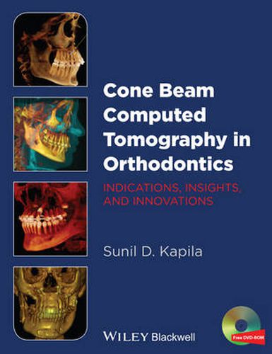 Cone Beam Computed Tomography in Orthodontics - Indications, Insights, and Innovations