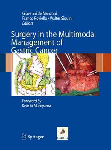 Cover image for Surgery in the Multimodal Management of Gastric Cancer