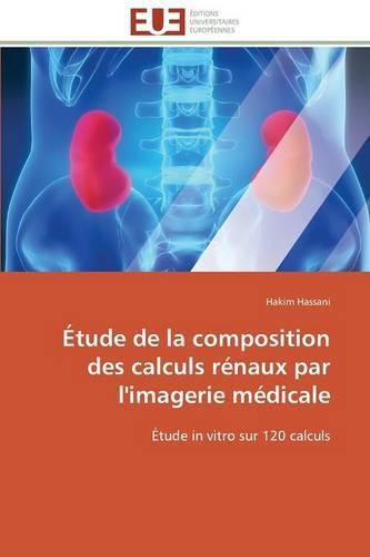 Cover image for  tude de la Composition Des Calculs R naux Par l'Imagerie M dicale