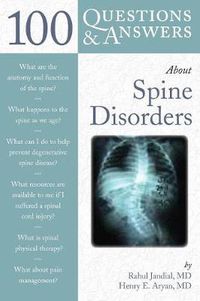 Cover image for 100 Questions  &  Answers About Spine Disorders