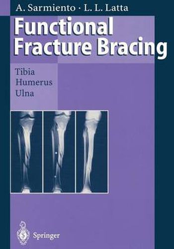 Cover image for Functional Fracture Bracing: Tibia, Humerus, and Ulna